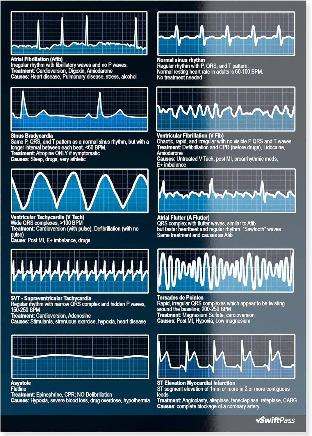 EKG Rhythm Interpretation Dual Sided for Nursing/Medical Students – Pocket ECG/EKG Cheat Card for Exam Study
